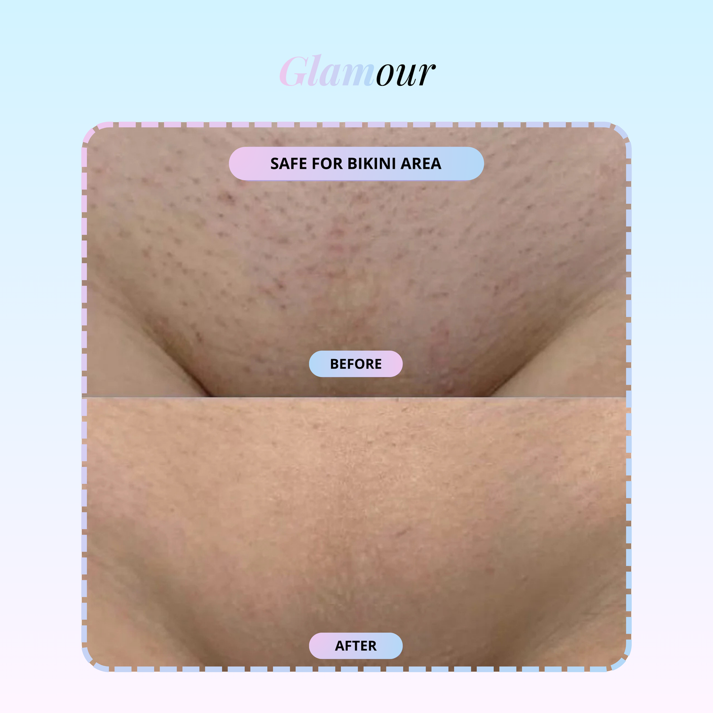 Glissem™ Crystal Hair Remover