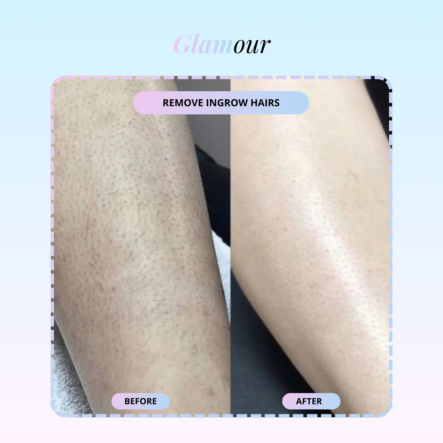 Glissem™ Crystal Hair Remover